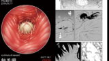 RJ139229 img main 160x90 - 触手卵